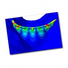برهم کنش میان سیال و سازه، Fluid-Structure Interaction