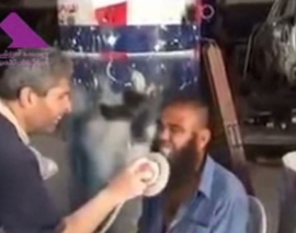 ساب زدن دندان های کارگر با فرز جهت زیبایی! ساب زدن دندان های کارگر با فرز جهت زیبایی!